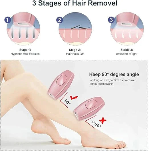 IPL Laser Hair Removal |الحل الرائد في المنزل للحصول على بشرة ناعمة