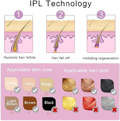IPL Laser Hair Removal |الحل الرائد في المنزل للحصول على بشرة ناعمة