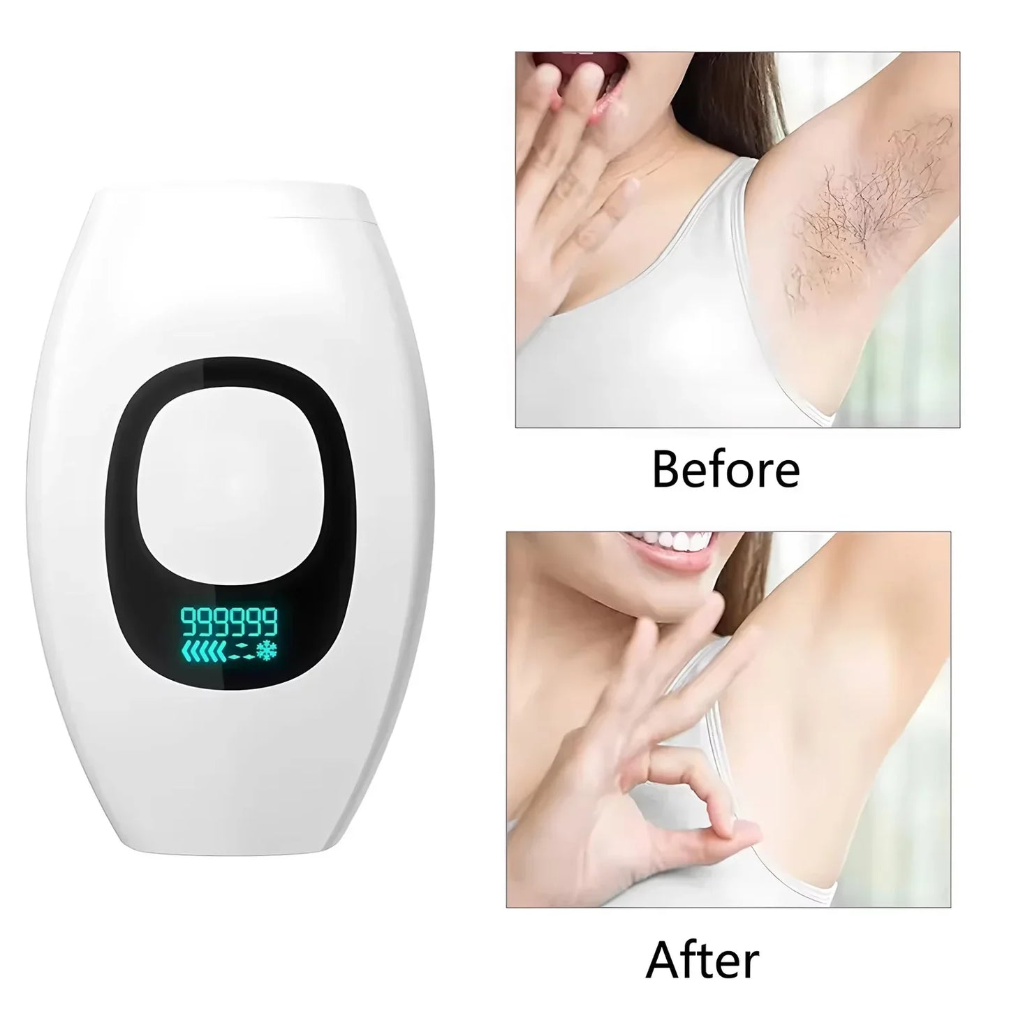 IPL Laser Hair Removal |الحل الرائد في المنزل للحصول على بشرة ناعمة