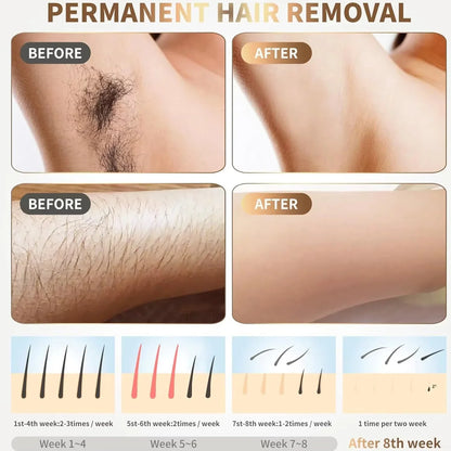IPL Laser Hair Removal |الحل الرائد في المنزل للحصول على بشرة ناعمة
