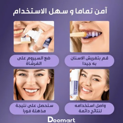 مصحح لون Hismile v34 | احصل على أسنان بيضاء في دقيقتين